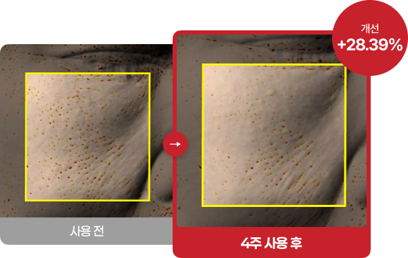 후기 사진