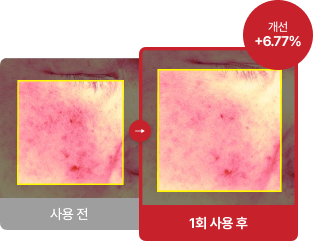 후기 사진